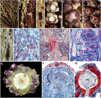 Meristem Genes in the Highly Reduced Endoparasitic Pilostyles boyacensis (Apodanthaceae)